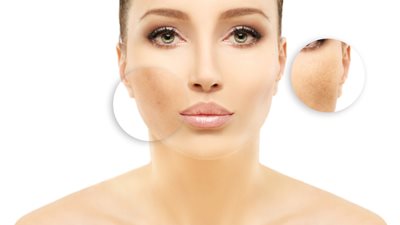 نصائح بسيطة لعلاج فرط التصبغ على جميع أنواع البشرة