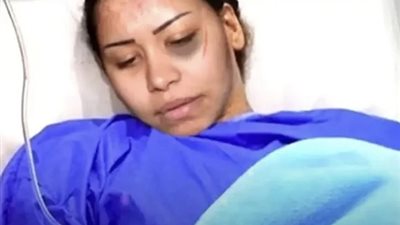 بعد اعتداء حسام حبيب.. تدهور الحالة الصحية ل شيرين عبد الوهاب ونقلها للمستشفى