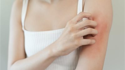 6 أطعمة تحارب الالتهابات والحساسية.. احرصٍ على تناولها 