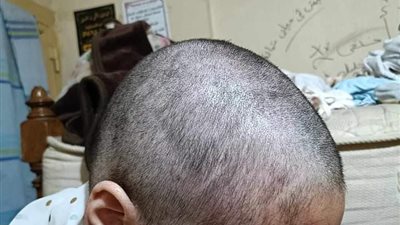  عذبوها وحلقوا شعرها.. تفاصيل تعرض فتاة للتعذيب على يد والدها وشقيقها 