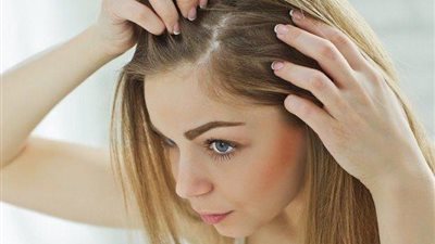 مع بداية الخريف.. وصفات طبيعية فعالة لعلاج قشرة الشعر