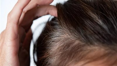 هل تعانين من الشيب المبكر؟.. السبب هذا الفيتامين 