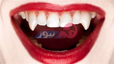 مع اقتراب الهالوين.. تريند أنياب مصاصي الدماء يشعل الجدل عبر تيكتوك.. وأطباء أسنان يحذرون