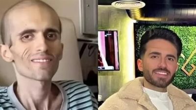 بعد وفاة أيمن العلي.. 5 خطوات تحميك من سرطان المعدة