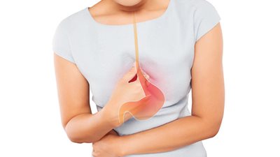 وزارة الصحة تكشف عن 6 أعراض لارتجاع المريء