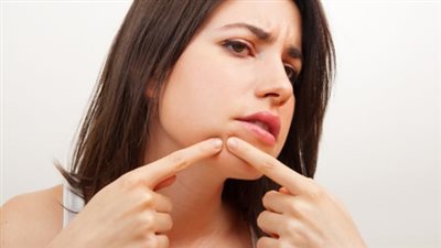 لو بتعاني من ظهور حب الشباب على الذقن.. الصحة تكشف الأسباب وطرق العلاج