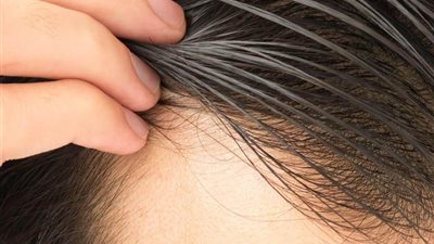 لزيادة نمو الشعر والعناية بفروة الرأس اتبعي هذه النصائح