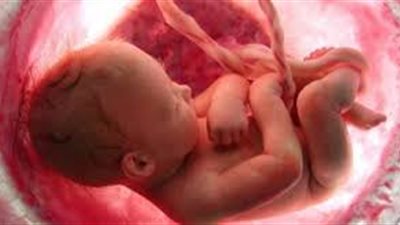 حالة نادرة | اكتشاف جنينين داخل رحم جنين في الهند