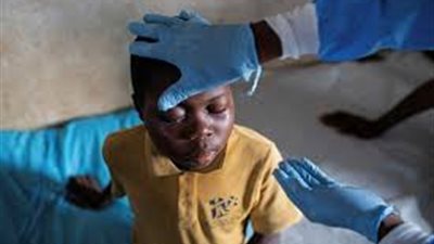 وجبة خفاش تثير الفزع في الكونغو بعد وفاة 50 شخصًا بمرض غامض