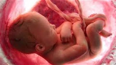 معجزة طبية | إزالة جنين من رأس طفلة أمريكية عمرها عام