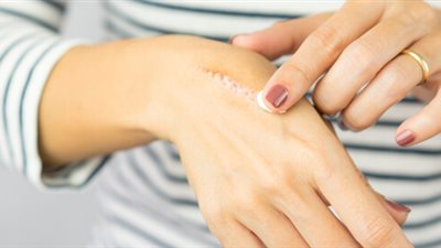 تفسير رؤية الجرح في المنام وعلاقته بالحصول علي الكثير من الأموال 