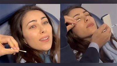 دانييلا رحمة تثير الجدل بفيديو عملية جراحية في عينها 