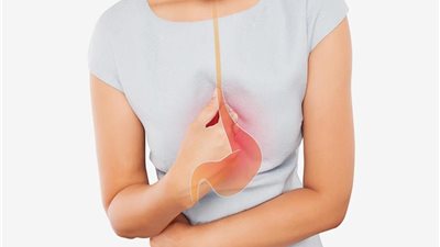 في إجازة العيد.. نصائح مهمة لتجنب الشعور بالحموضة