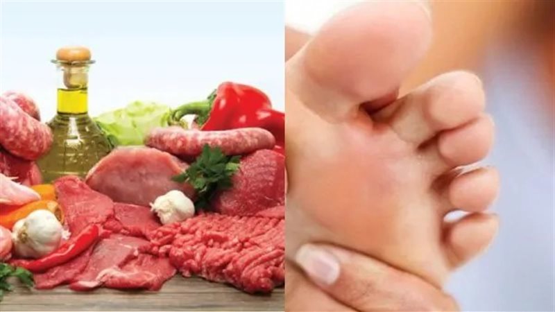 مرضي النقرس