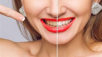 ما هي أسباب اصفرار الأسنان؟.. وزارة الصحة توضح 5 أسباب يجب تجنبها