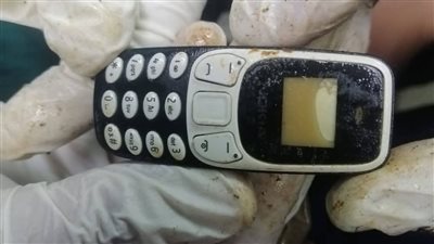 بعد عامين في المعدة.. فريق طبي بجامعة الأزهر بأسيوط ينجح في استخراج هاتف محمول من مريض دون جراحة