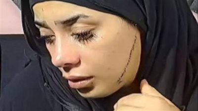 فتاة مصر القديمة ضحية انتقام عاطفي… 41 غرزة تنقذ حياتها