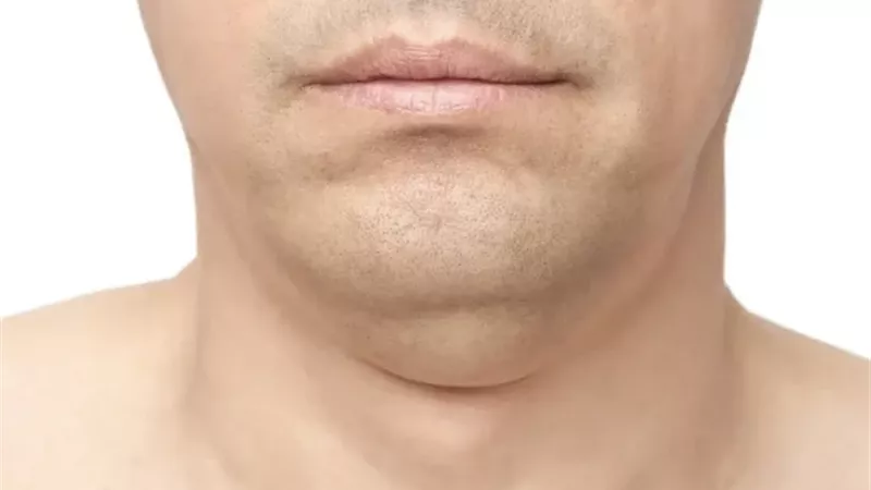 هير نيوز