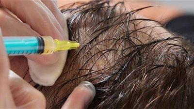 أضرار ومخاطر تقنية «الريجينيرا».. وطرق الوقاية منها