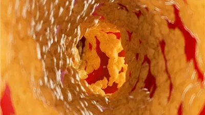 دراسة: دهون خفية تهدد صحة الشرايين