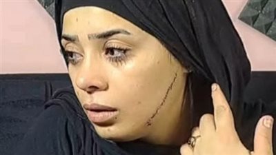 محكمة جنايات القاهرة تنظر أولى جلسات محاكمة المتهمة بتشويه وجه عروس مصر القديمة