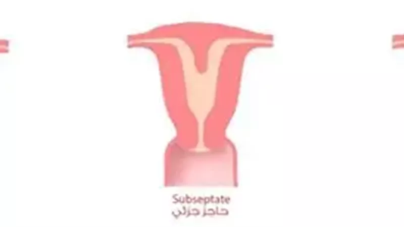 الحاجز الرحمي 