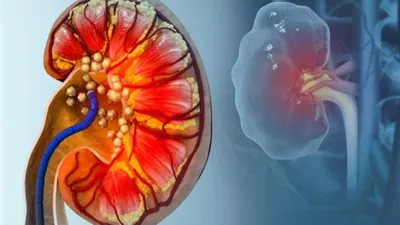 بول الثعابين يعالج النقرس والحصوات