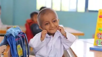 متلازمة سيكل.. اضطراب وراثي نادر «أعراضه وطرق العلاج» 