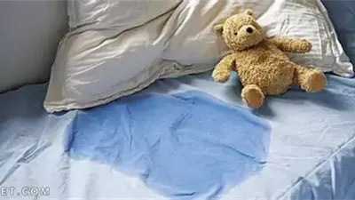 تشخيص صادم لطبيبة عن أسباب التبول اللاإرادي.. ومتى يتم تشخيصه؟