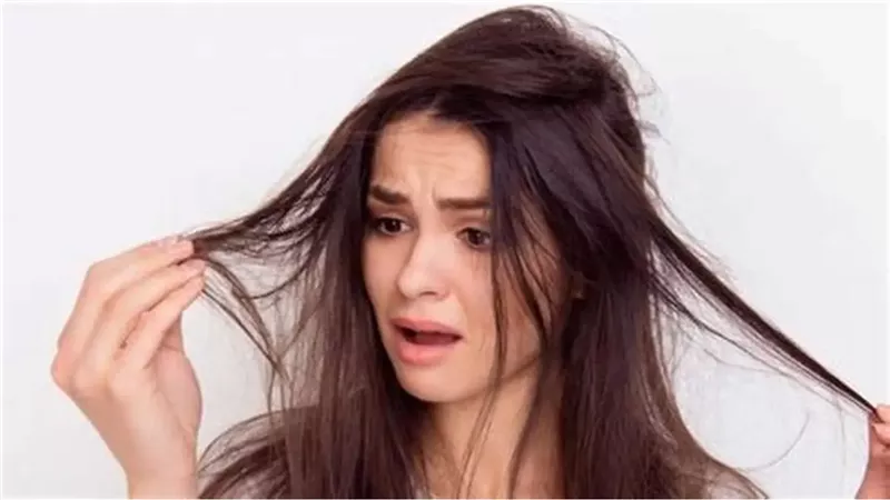 تلف الشعر بالشتاء 