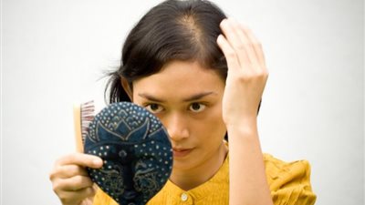 الصلع الهرموني عند النساء.. كيف تتغلبي عليه بطرق علاجية حديثة؟