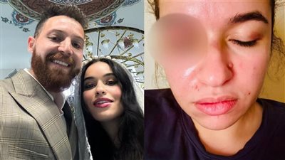 محمود حجازي يرد على اتهامه بالتعدي على زوجته: سبب الضرب سفر نجلي