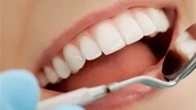 وتد طبي جديد بديل لزراعة الأسنان