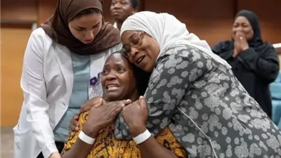 نجاح عملية فصل التوأم التنزاني نانسي ونايس