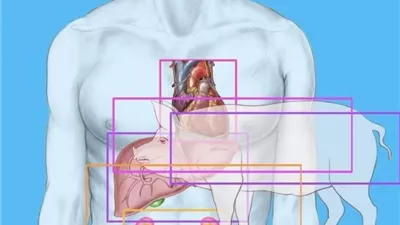 نجاح مؤقت لزرع أعضاء خنزير داخل الإنسان