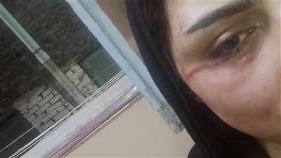 سيدة تستغيث بوزارة الداخلية: «تعرضت للاعتداء من زوجي وطُردت من منزلي»