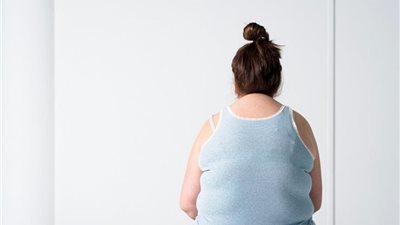 أستاذ جراحة: 50% من السيدات يُصبن بأمراض السمنة.. فيديو