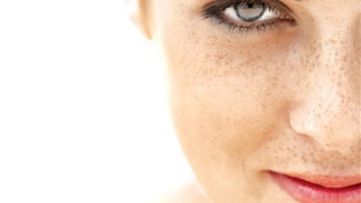  النمش علامة.. ما علاقة عصير البرتقال بسرطان الجلد؟.. دراسة تجيب