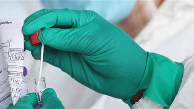 الصحة: 709 إصابات جديدة بكورونا و40 حالة وفاة