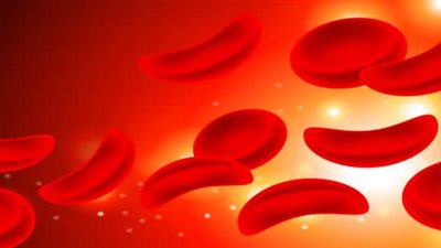 5 أنواع من الاضطرابات الجينية تهدد حياة طفلك