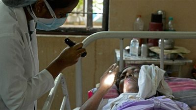 أعراض مرض الفطر الأسود 2021..  15 عرضًا تحذرك.. 6 خطوات للوقاية منه