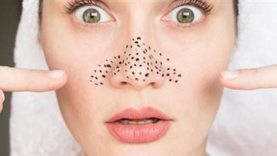 حل سحري للتخلص من البثور السوداء في البشرة