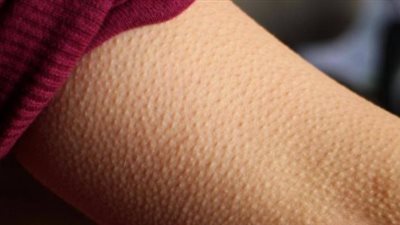 «إزاي اتخلص من جلد الوزة؟».. خبيرة تجميل تُجيب في 14 نقطة 