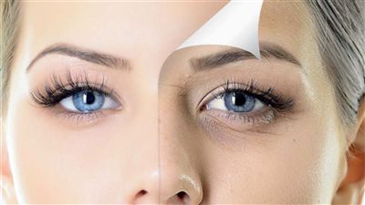 بوصفات طبيعية.. 4 طرق لإزالة التجاعيد تحت العين نهائيًا