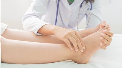 تورم القدمين عند النساء.. الأسباب والعلاج