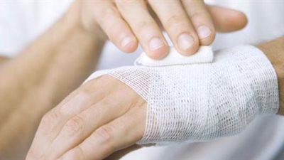 عيّد من غير إصابات.. الإسعافات الأولية لحروق حفلات الشواء