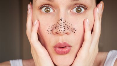 6 طرق بسيطة تقضي على الرؤوس السوداء