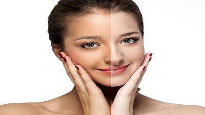 «كوني جميلة».. 6 طرق طبيعية لتفتيح البشرة والتخلص من البقع