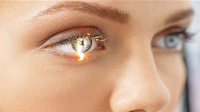 تعرفي على أسباب إصابة العين بالمياه الزرقاء| فيديو