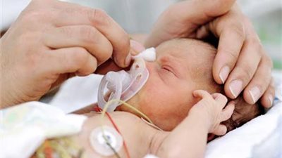 فيديو.. الصحة تعلن أكثر الأمراض التي تصيب الأطفال المبتسرين